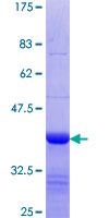 12.5% SDS-PAGE Stained with Coomassie Blue.